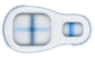 Pregnant result